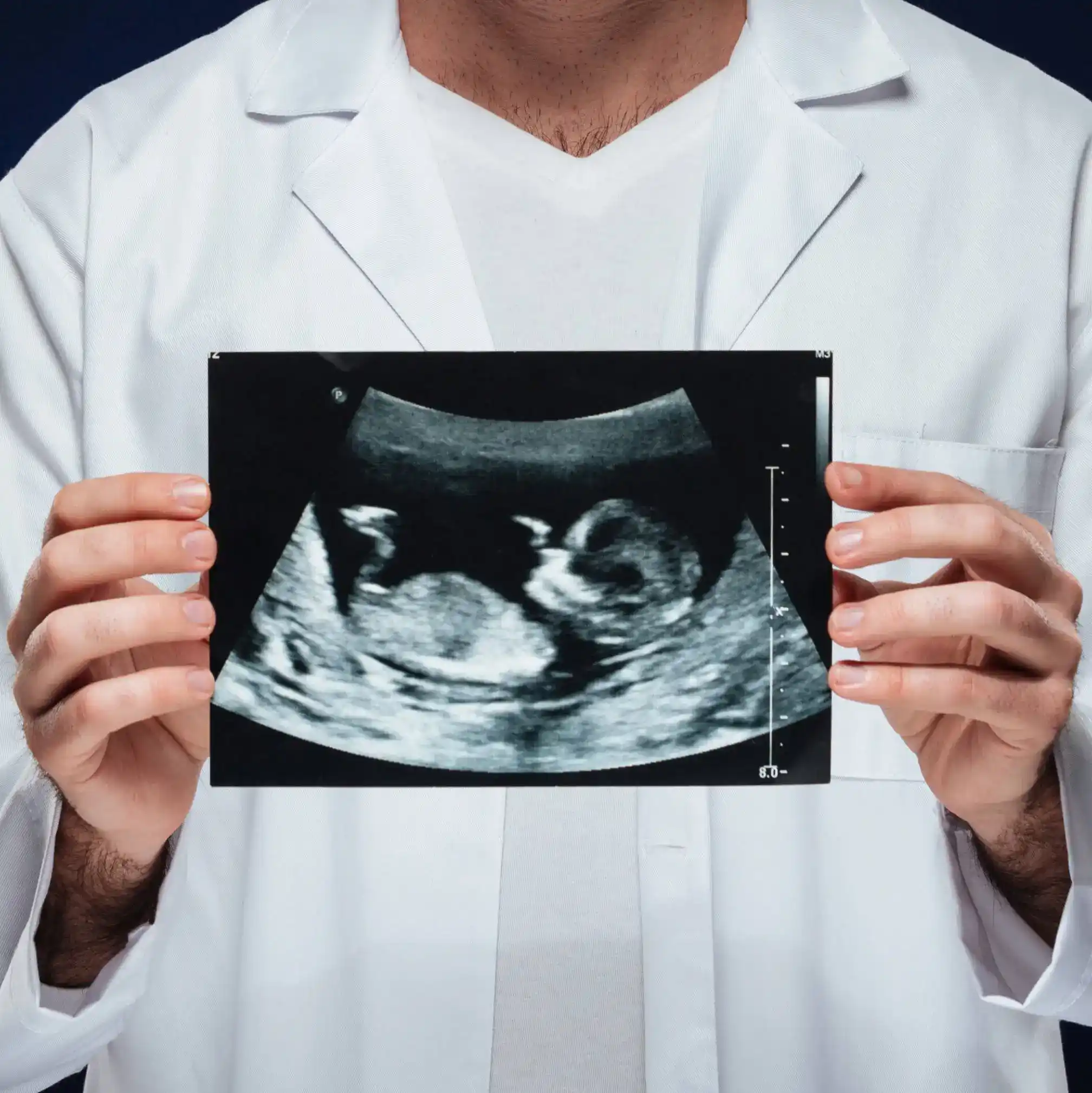 ultrasound page